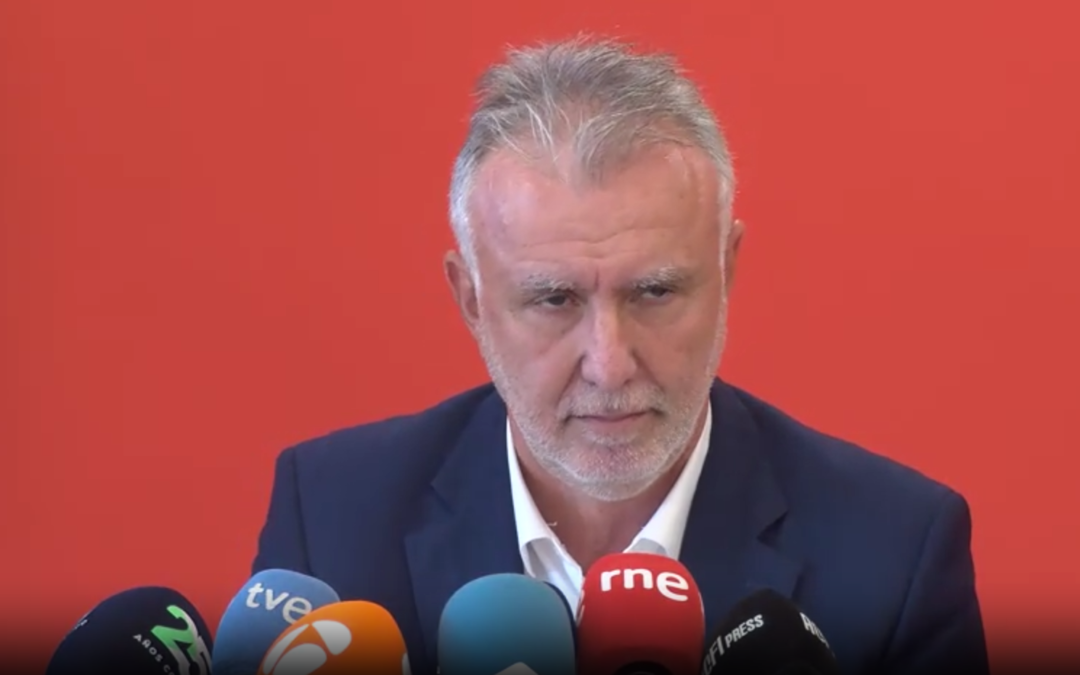 La cara de Torres